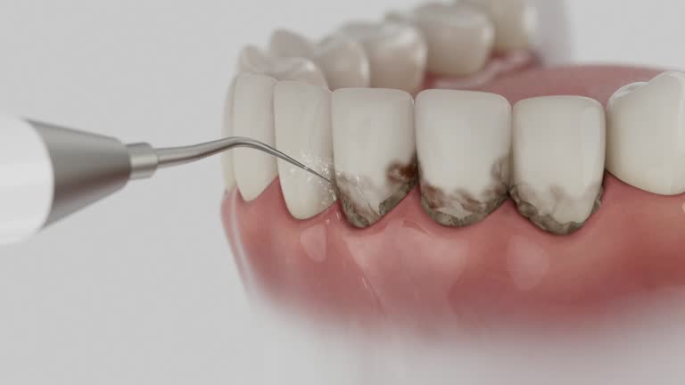 Reliable Dental contractor in Spicer, MN by Smile Center Dentistry